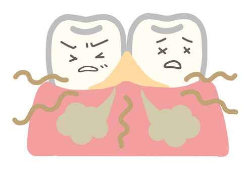 歯垢と歯石の違いについて