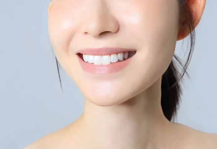 銀歯を使わずに歯を修復