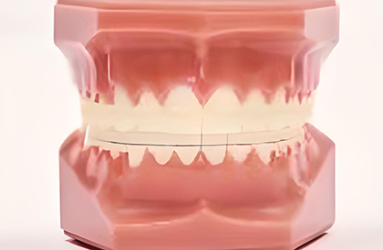 白色ブラケットタイプ