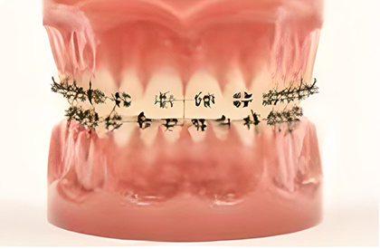 銀色ブラケットタイプ