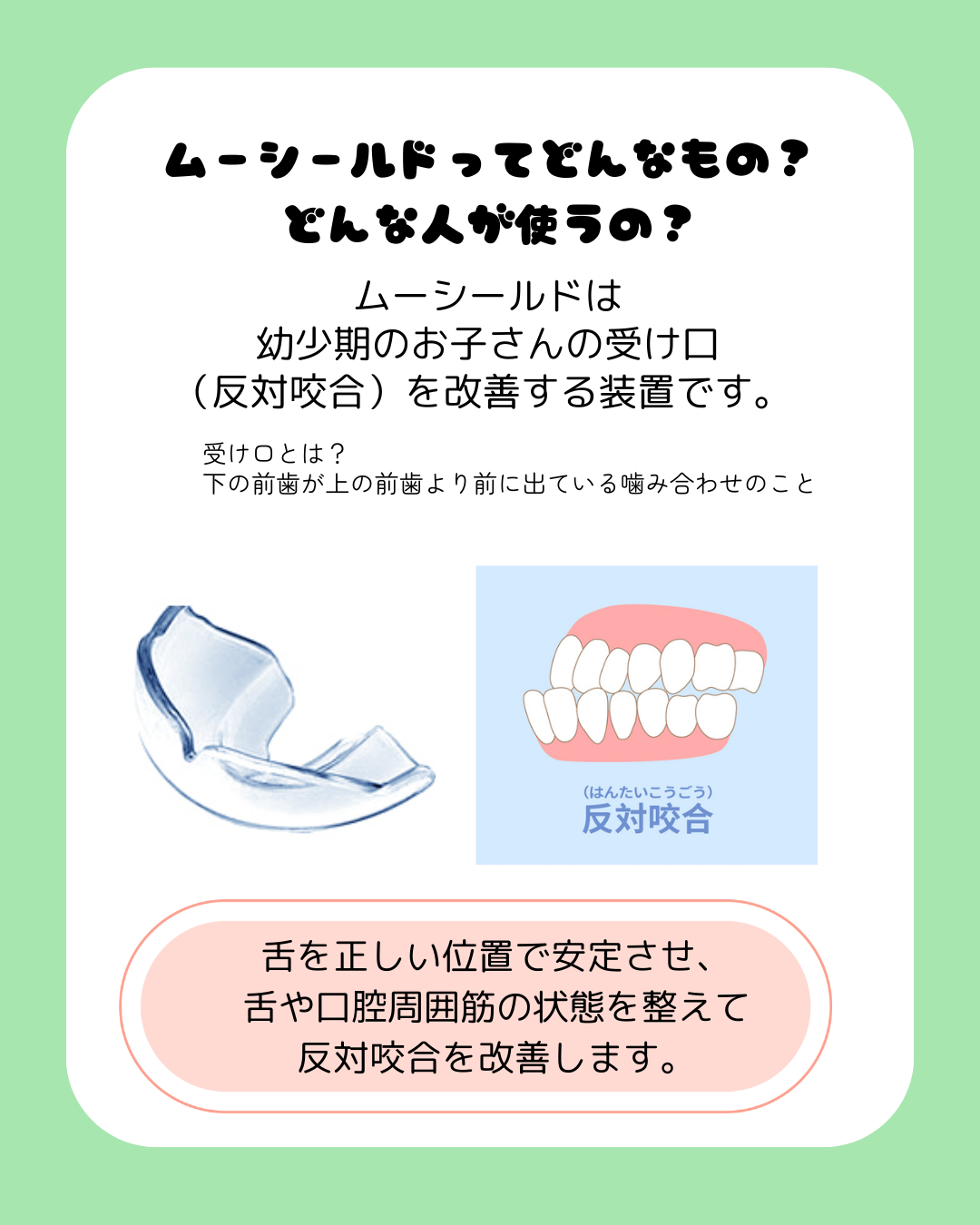知ってる？ムーシールドについて