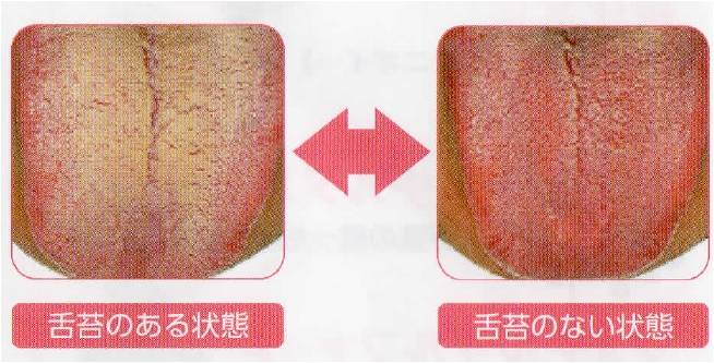 👅口臭が気になる方へ👅